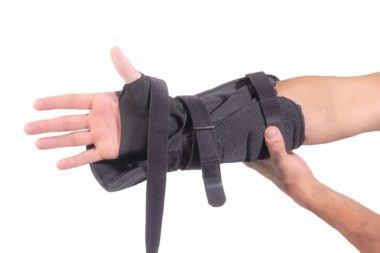 Fitting Aluminum forms to functional wrist brace