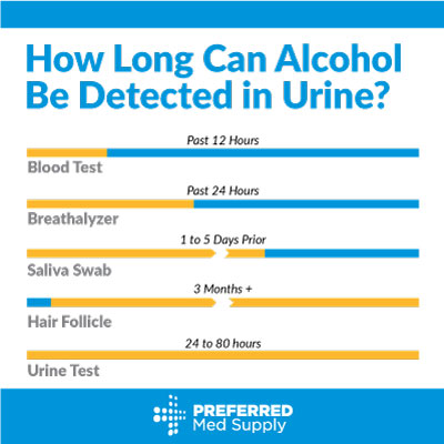 Common Detection Timelines for methods of testing alcohol