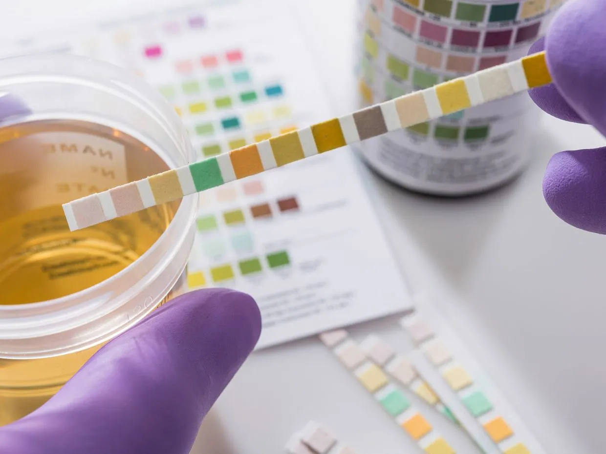 Drug Tests Employers Will Use