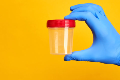 order drug test cup online